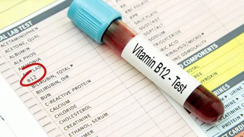 Vitamin-B12-Mangel: Symptome, Ursachen und Risikogruppen