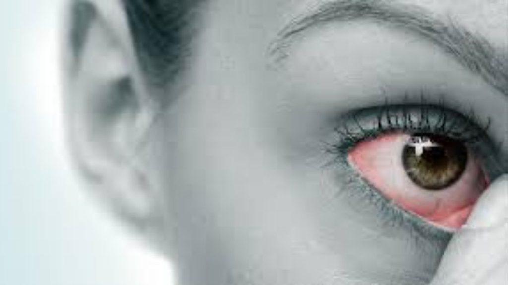 Trockene Augen: Häufige Ursachen und wie Sie Ihre Augen schützen